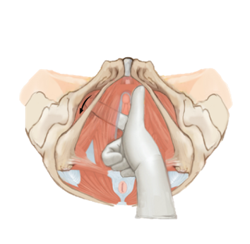 Мануальная терапия тазового дна